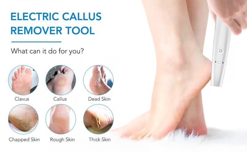 🌸LIMITED SALE : ONLY ￡9.99!!🌸Electric Feet Callus Remover